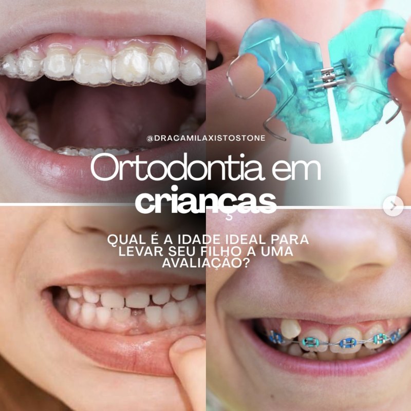 Ortodontia em crianças