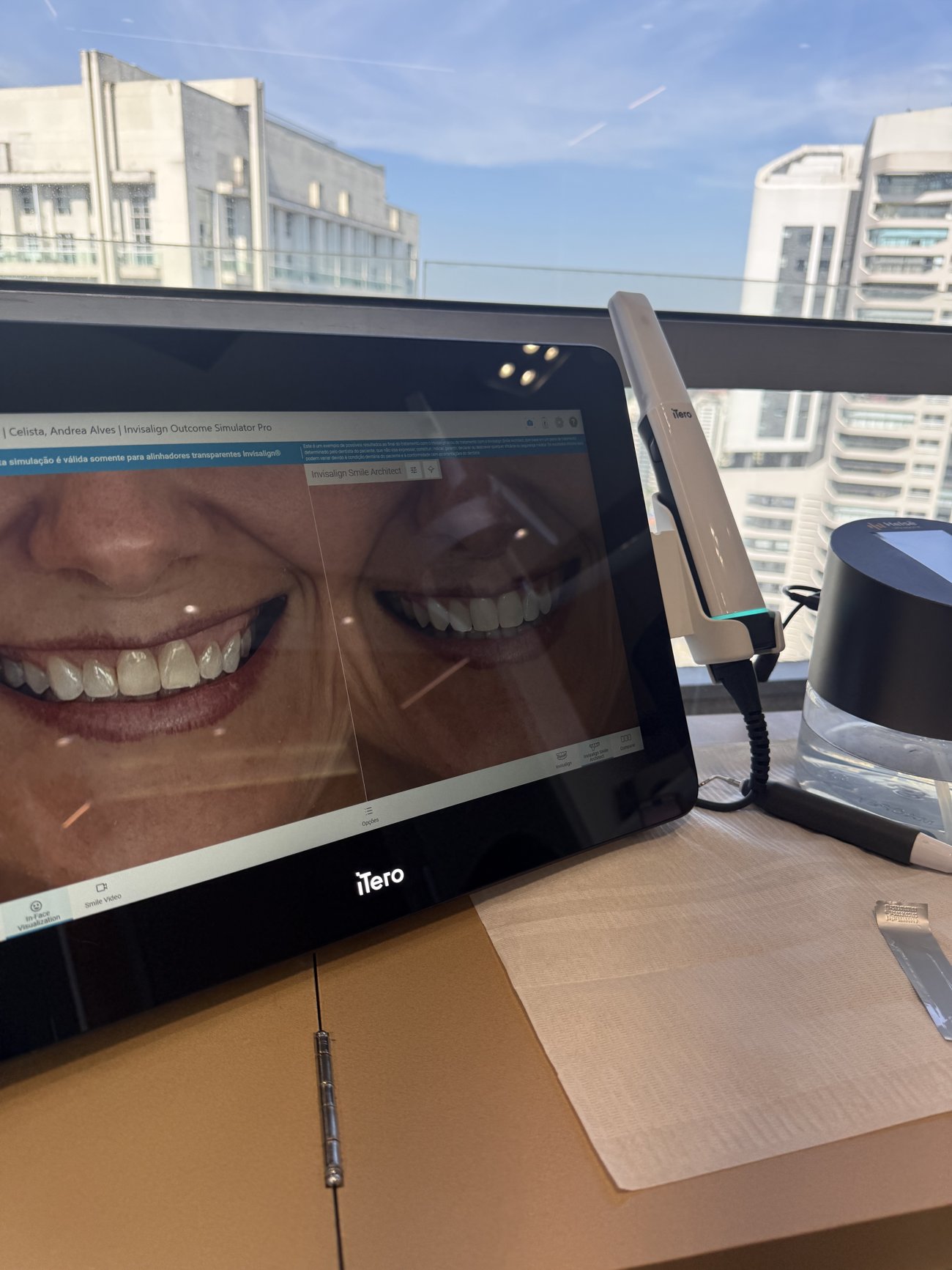 Escaneamento 3D com iTero Lumina