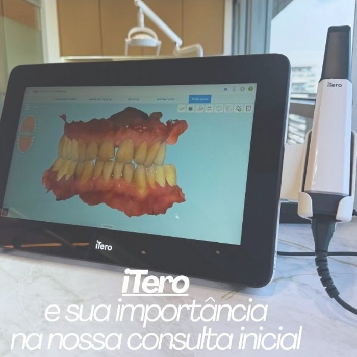 iTero na consulta inicial